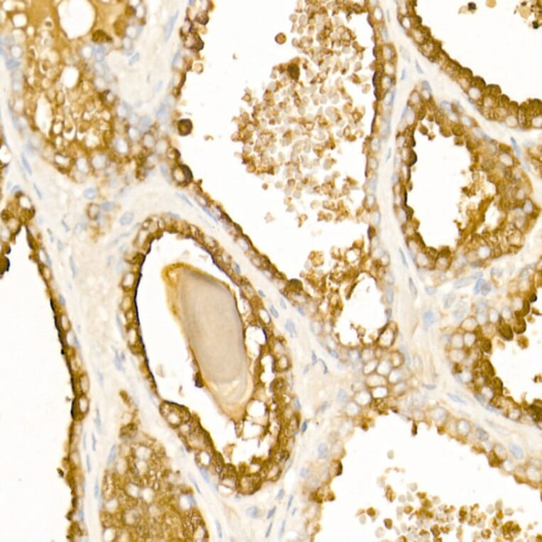 Immunohistochemistry - Anti-PAP Antibody (A13757) - Antibodies.com