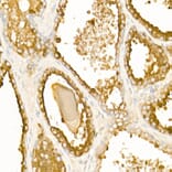 Immunohistochemistry - Anti-PAP Antibody (A13757) - Antibodies.com