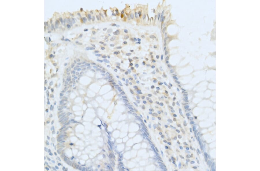 Immunohistochemistry - Anti-PAP Antibody (A13757) - Antibodies.com