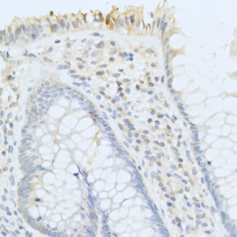 Immunohistochemistry - Anti-PAP Antibody (A13757) - Antibodies.com