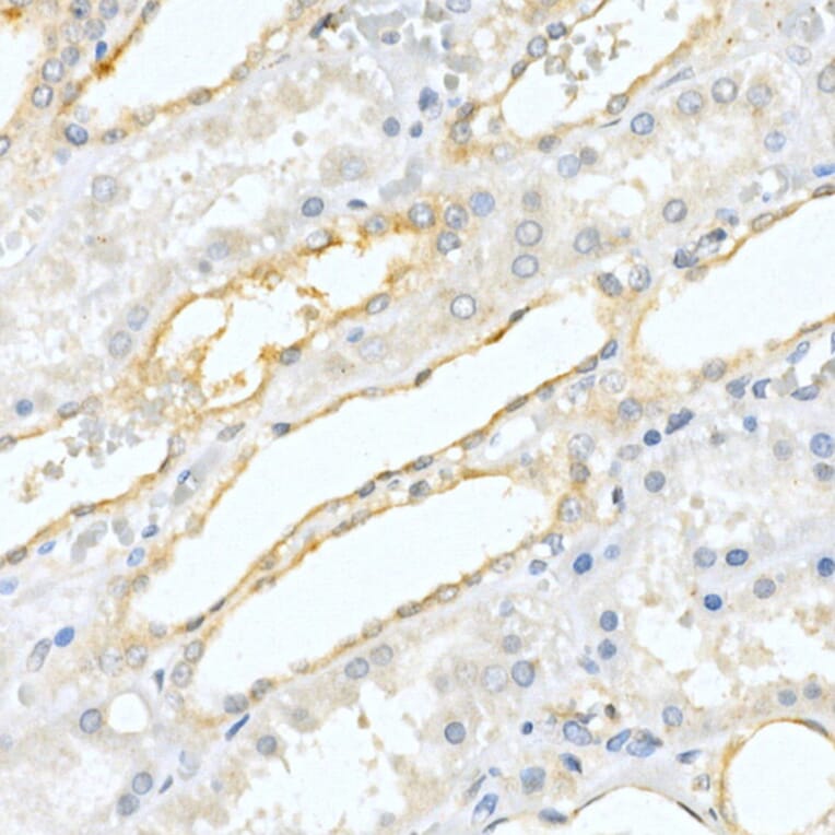 Immunohistochemistry - Anti-PAP Antibody (A13757) - Antibodies.com