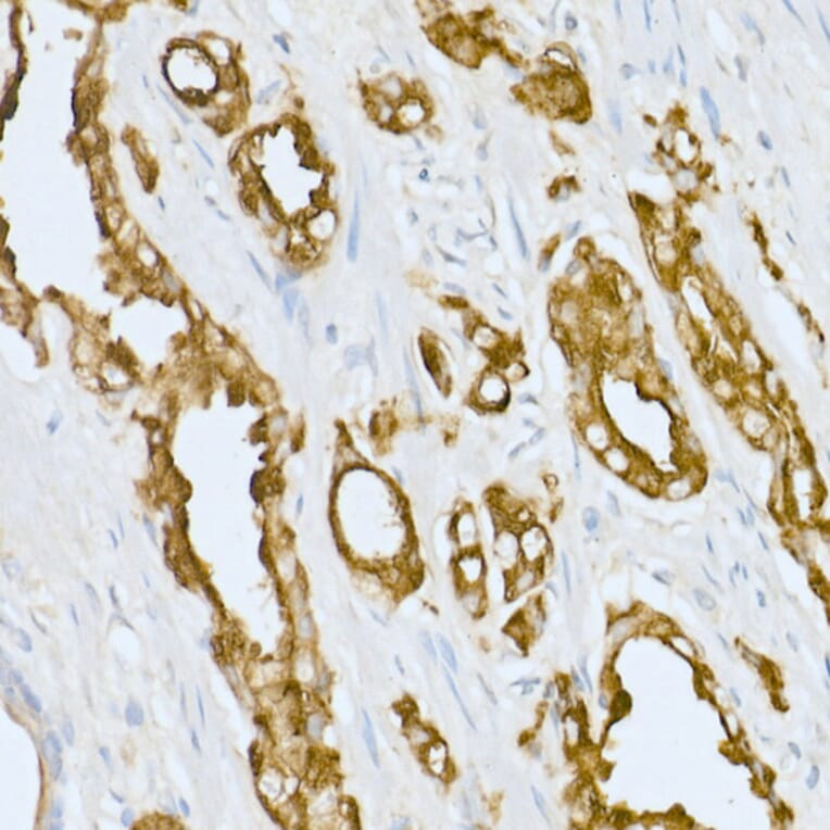 Immunohistochemistry - Anti-PAP Antibody (A13757) - Antibodies.com