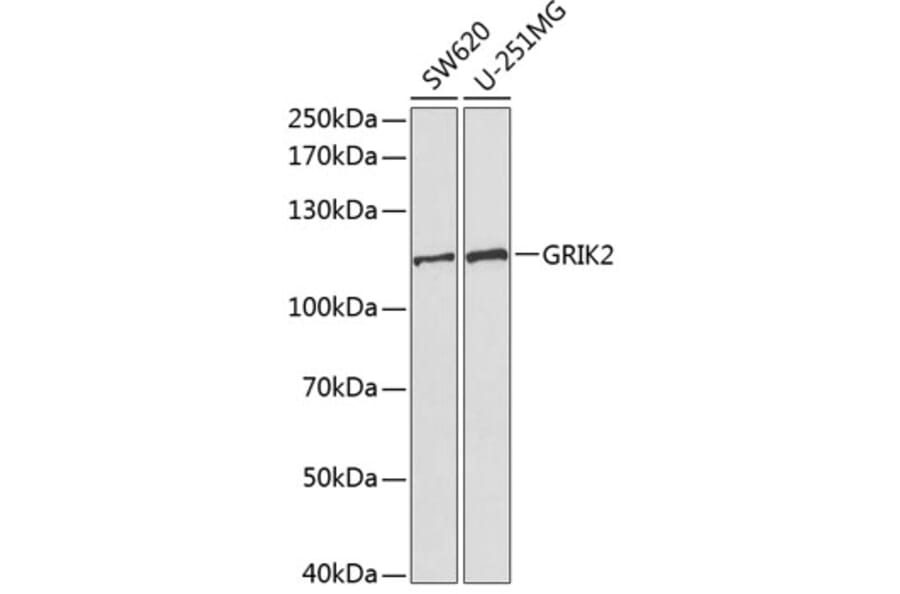 Western Blot - Anti-GRIK2/GluK2 Antibody (A13758) - Antibodies.com
