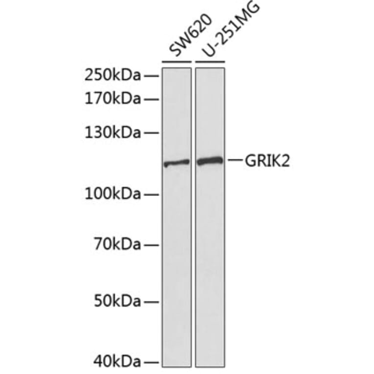 Western Blot - Anti-GRIK2/GluK2 Antibody (A13758) - Antibodies.com