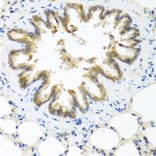 Immunohistochemistry - Anti-Psoriasin Antibody (A13759) - Antibodies.com