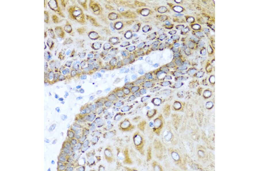 Immunohistochemistry - Anti-Psoriasin Antibody (A13759) - Antibodies.com