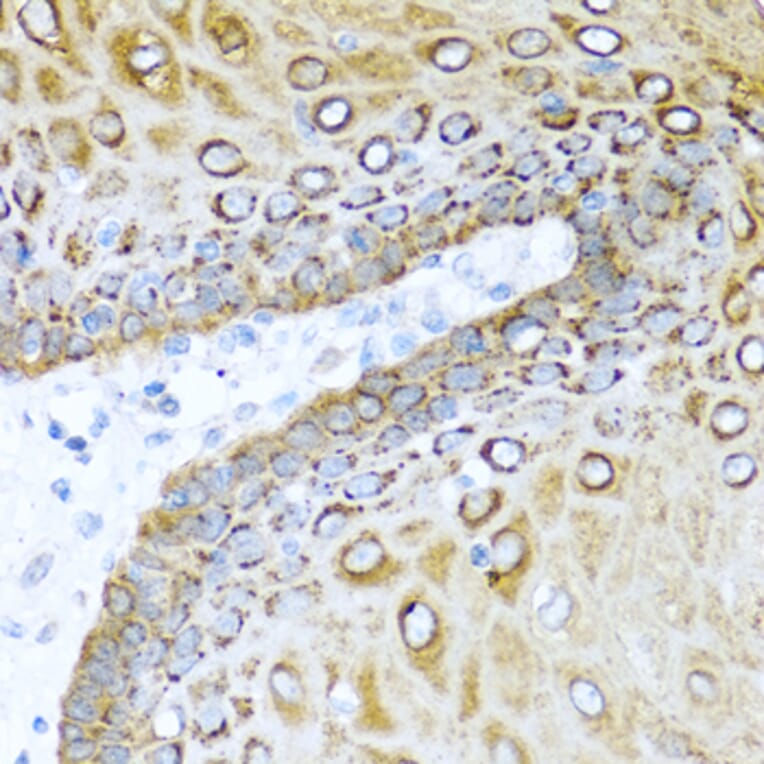 Immunohistochemistry - Anti-Psoriasin Antibody (A13759) - Antibodies.com