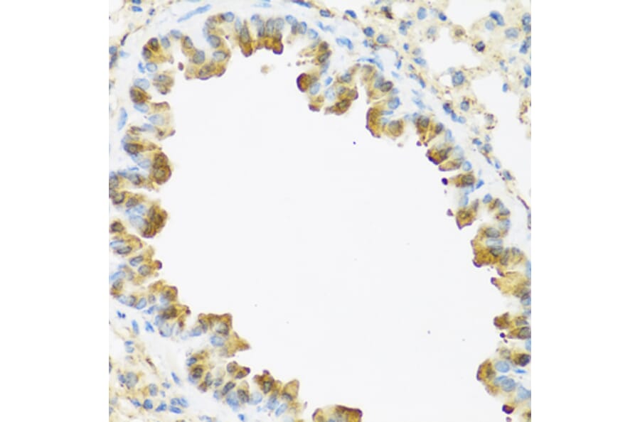 Immunohistochemistry - Anti-Psoriasin Antibody (A13759) - Antibodies.com