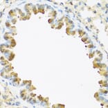 Immunohistochemistry - Anti-Psoriasin Antibody (A13759) - Antibodies.com