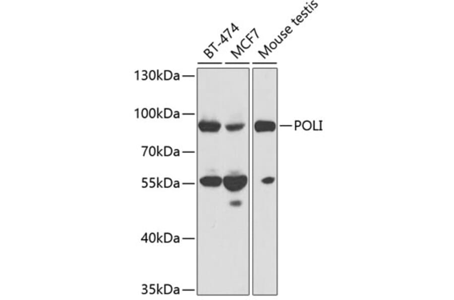Western Blot - Anti-DNA Polymerase iota Antibody (A13760) - Antibodies.com