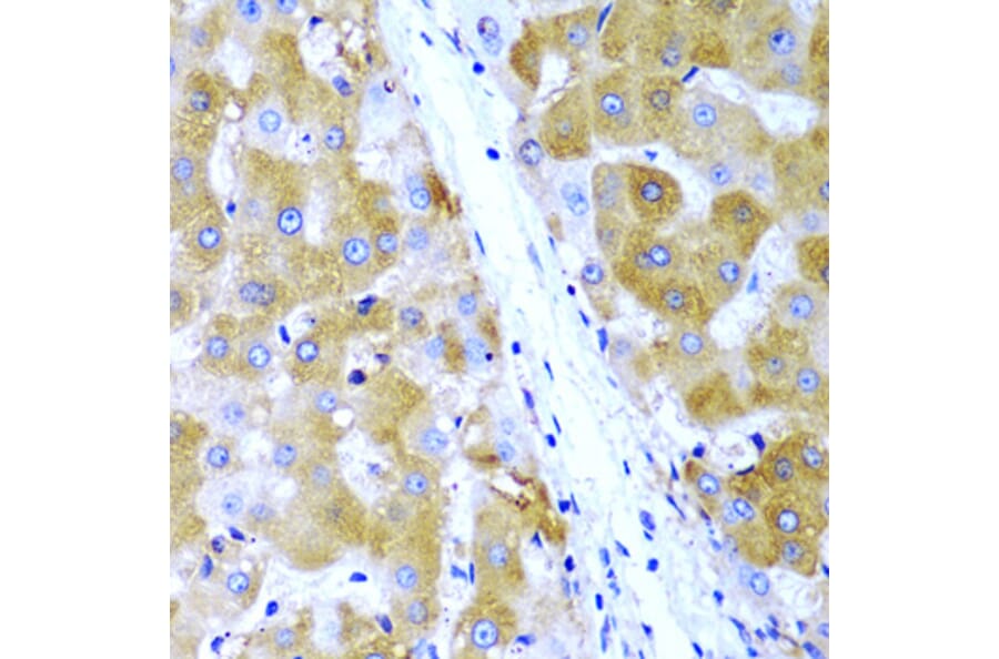 Immunohistochemistry - Anti-TIRAP Antibody (A13761) - Antibodies.com