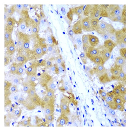Immunohistochemistry - Anti-TIRAP Antibody (A13761) - Antibodies.com