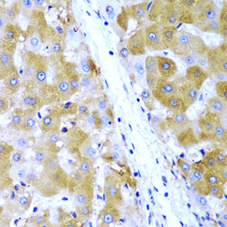 Immunohistochemistry - Anti-TIRAP Antibody (A13761) - Antibodies.com