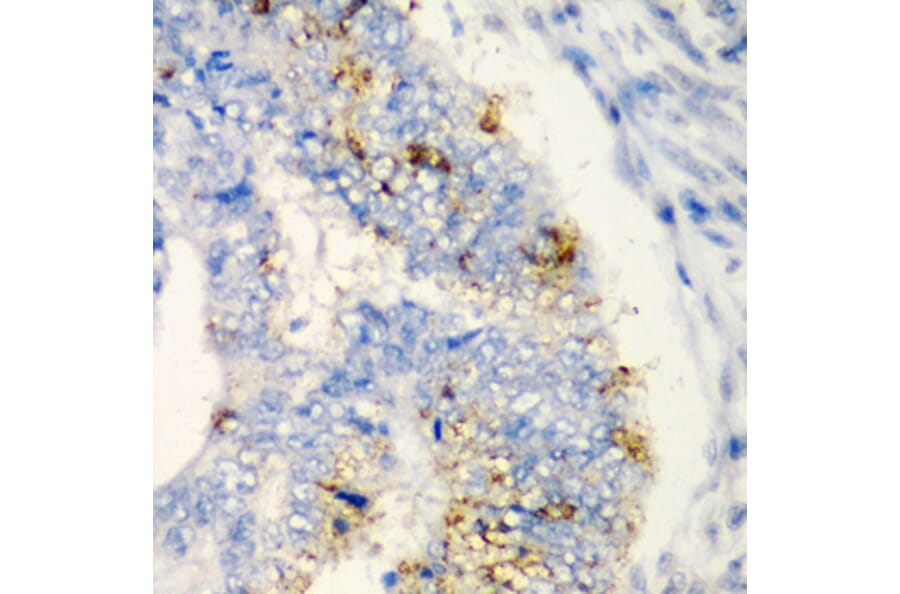 Immunohistochemistry - Anti-TIRAP Antibody (A13761) - Antibodies.com