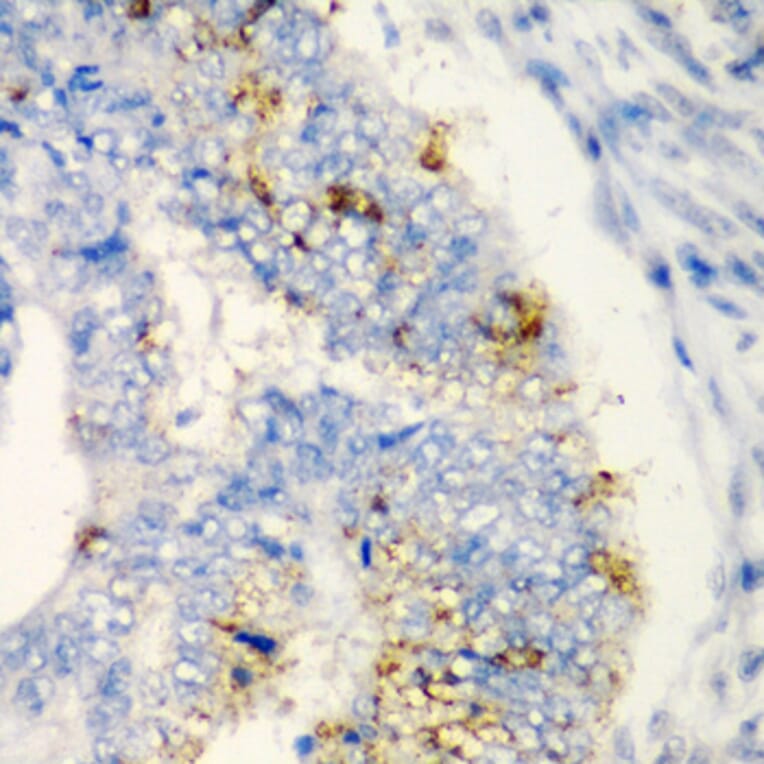 Immunohistochemistry - Anti-TIRAP Antibody (A13761) - Antibodies.com