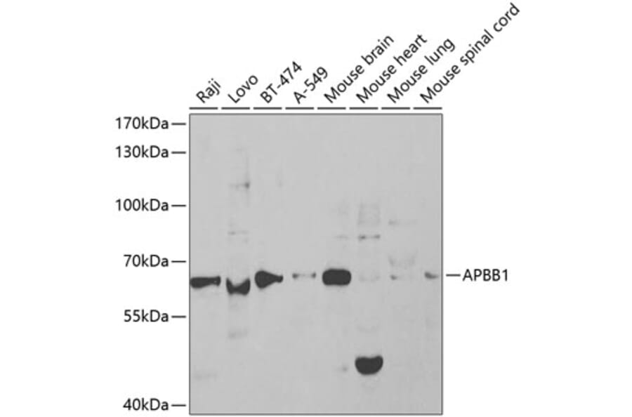 Western Blot - Anti-FE65 Antibody (A13762) - Antibodies.com