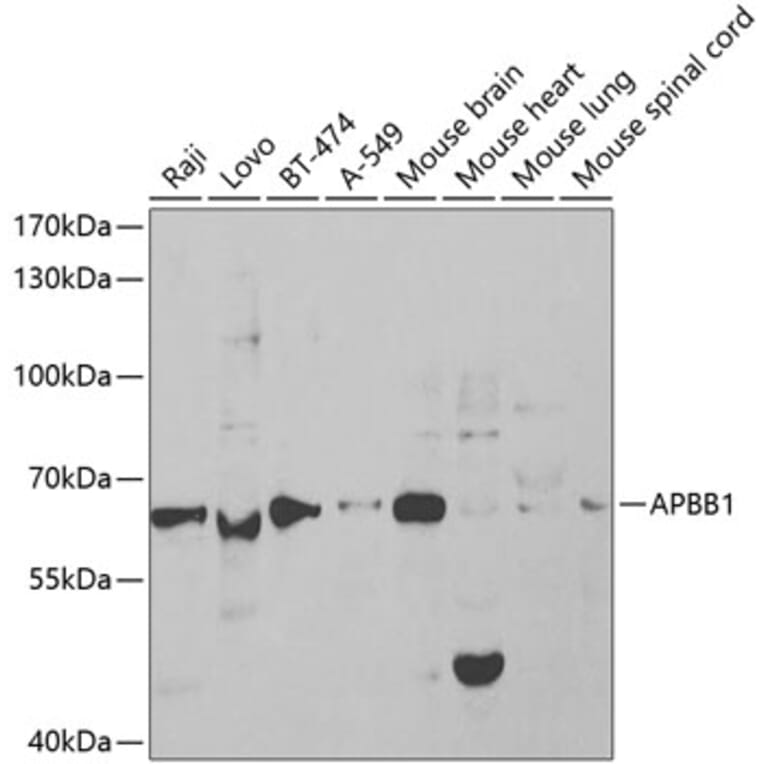 Western Blot - Anti-FE65 Antibody (A13762) - Antibodies.com