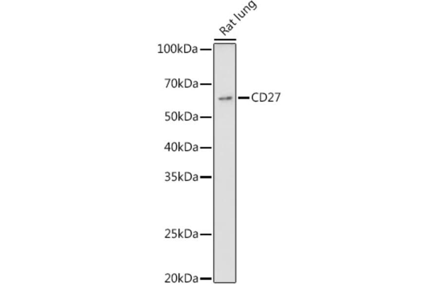 Western Blot - Anti-CD27 Antibody (A13763) - Antibodies.com