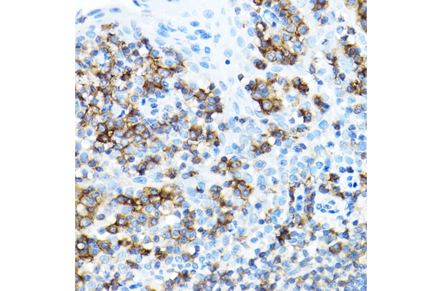 Immunohistochemistry - Anti-CD27 Antibody (A13763) - Antibodies.com