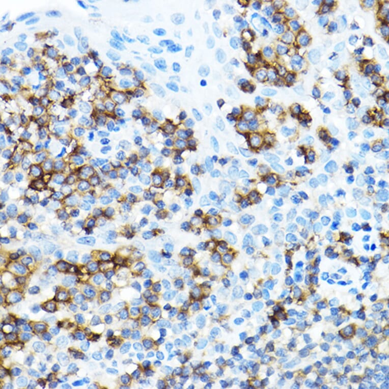 Immunohistochemistry - Anti-CD27 Antibody (A13763) - Antibodies.com