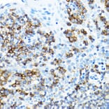 Immunohistochemistry - Anti-CD27 Antibody (A13763) - Antibodies.com