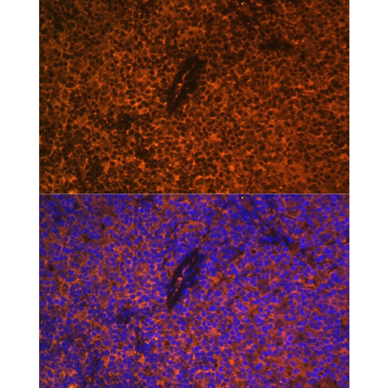 Immunofluorescence - Anti-CD27 Antibody (A13763) - Antibodies.com