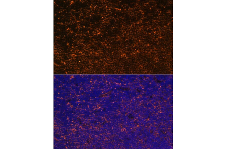 Immunofluorescence - Anti-CD27 Antibody (A13763) - Antibodies.com