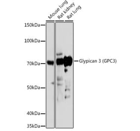 Western Blot - Anti-Glypican 3 Antibody (A13764) - Antibodies.com