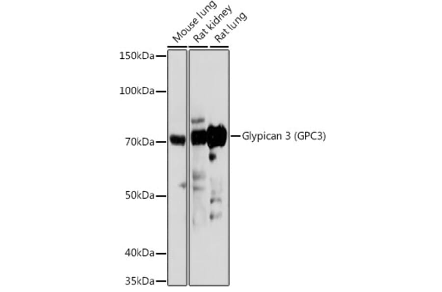 Western Blot - Anti-Glypican 3 Antibody (A13764) - Antibodies.com