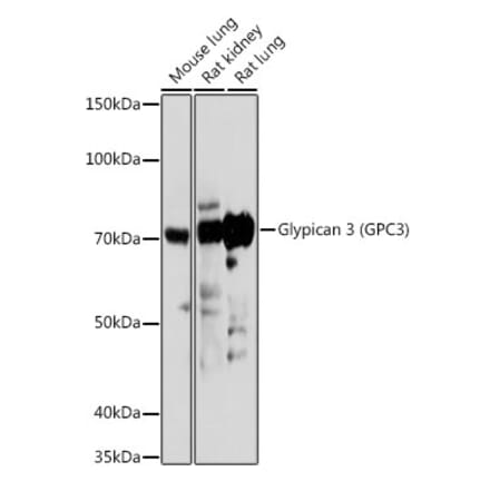 Western Blot - Anti-Glypican 3 Antibody (A13764) - Antibodies.com