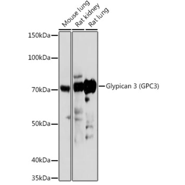 Western Blot - Anti-Glypican 3 Antibody (A13764) - Antibodies.com