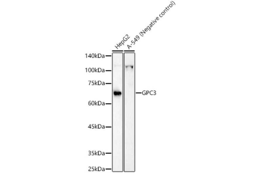 Western Blot - Anti-Glypican 3 Antibody (A13764) - Antibodies.com