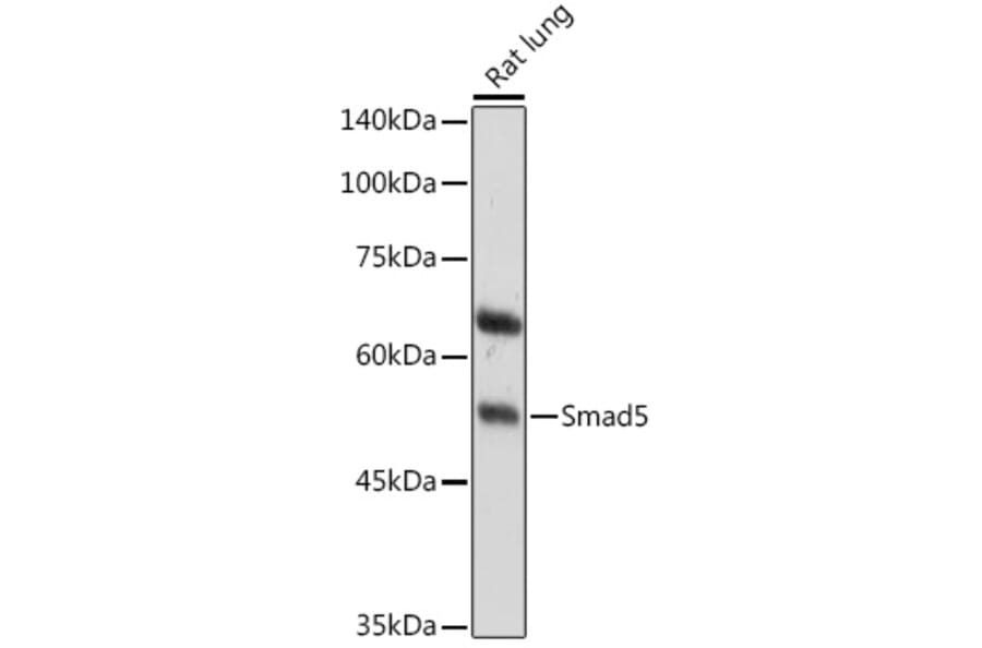 Western Blot - Anti-SMAD5 Antibody (A13765) - Antibodies.com
