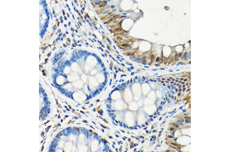 Immunohistochemistry - Anti-SMAD5 Antibody (A13765) - Antibodies.com