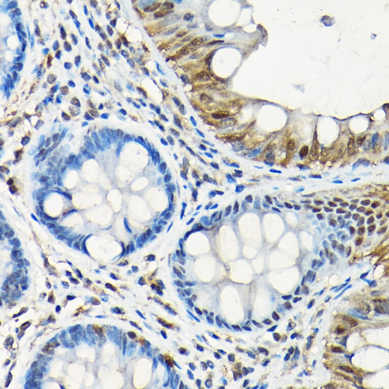 Immunohistochemistry - Anti-SMAD5 Antibody (A13765) - Antibodies.com