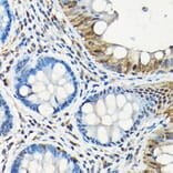 Immunohistochemistry - Anti-SMAD5 Antibody (A13765) - Antibodies.com