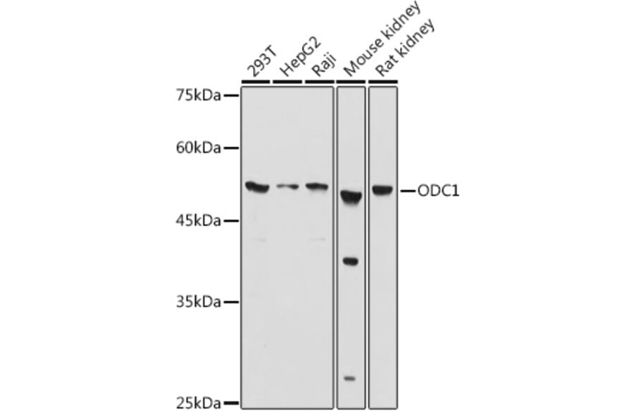 Western Blot - Anti-Ornithine Decarboxylase/ODC Antibody (A13766) - Antibodies.com