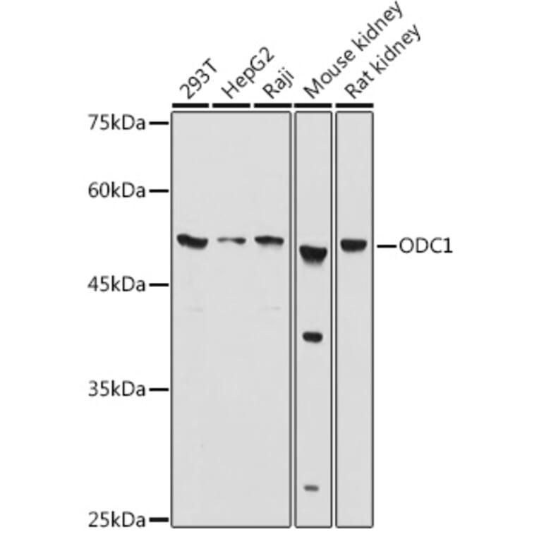 Western Blot - Anti-Ornithine Decarboxylase/ODC Antibody (A13766) - Antibodies.com
