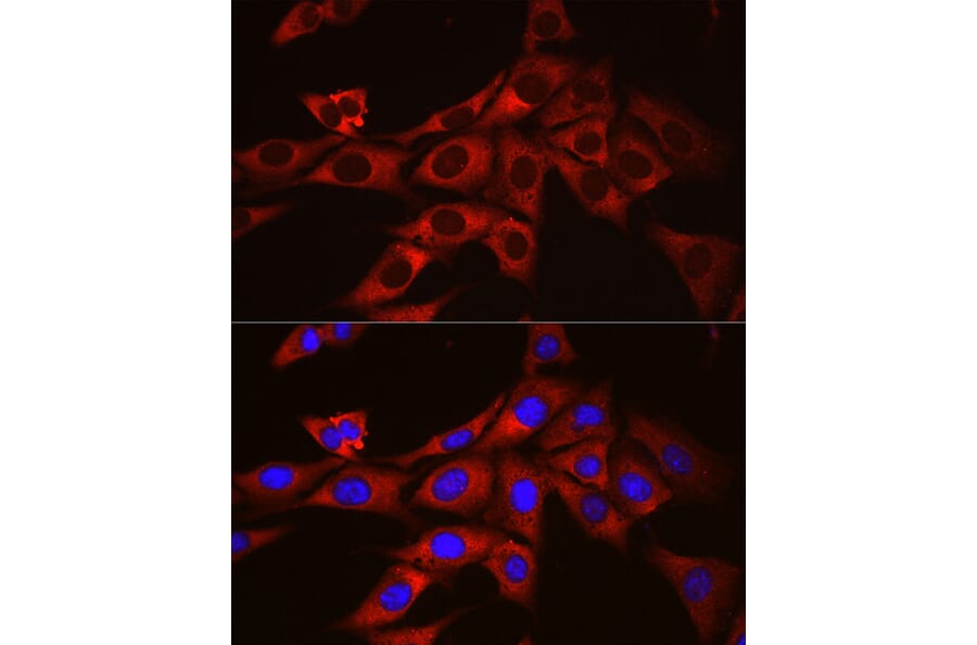 Immunofluorescence - Anti-Ornithine Decarboxylase/ODC Antibody (A13766) - Antibodies.com