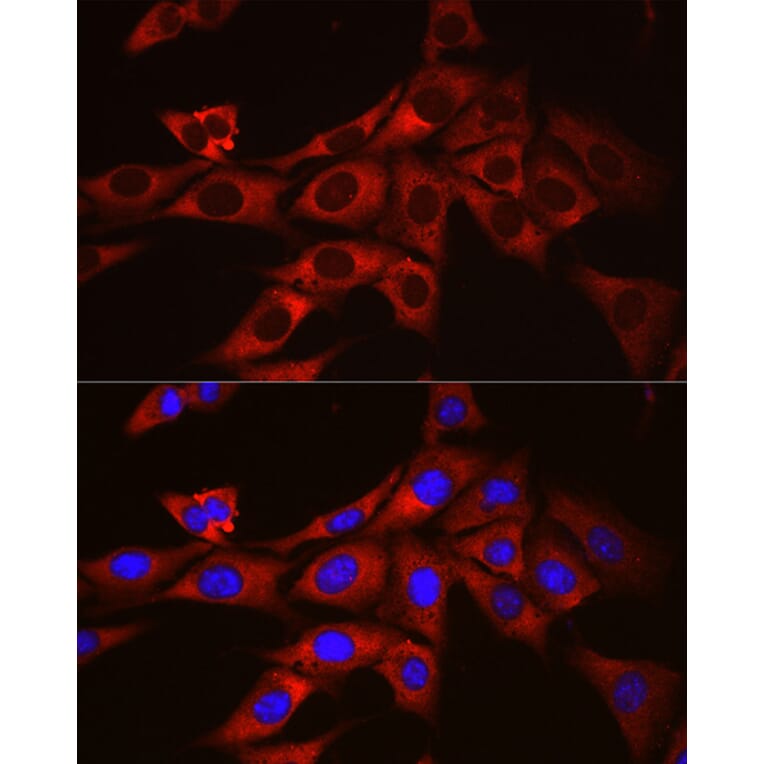 Immunofluorescence - Anti-Ornithine Decarboxylase/ODC Antibody (A13766) - Antibodies.com