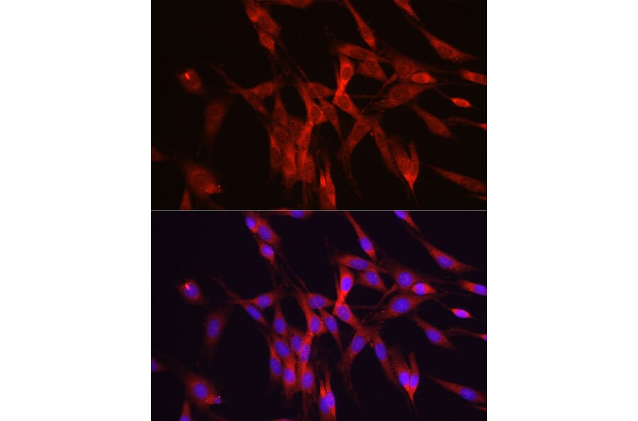 Immunofluorescence - Anti-Ornithine Decarboxylase/ODC Antibody (A13766) - Antibodies.com