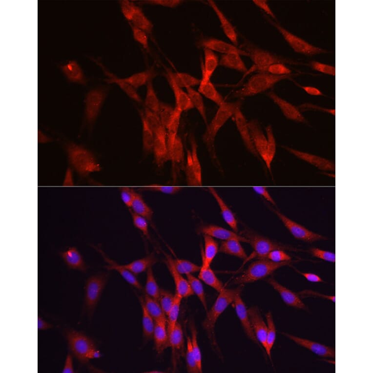 Immunofluorescence - Anti-Ornithine Decarboxylase/ODC Antibody (A13766) - Antibodies.com