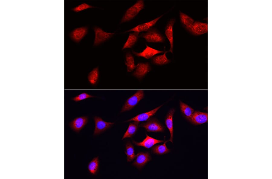 Immunofluorescence - Anti-Ornithine Decarboxylase/ODC Antibody (A13766) - Antibodies.com