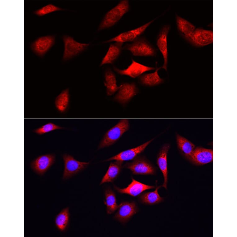 Immunofluorescence - Anti-Ornithine Decarboxylase/ODC Antibody (A13766) - Antibodies.com