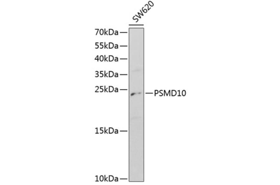 Western Blot - Anti-PSMD10 Antibody (A1949) - Antibodies.com