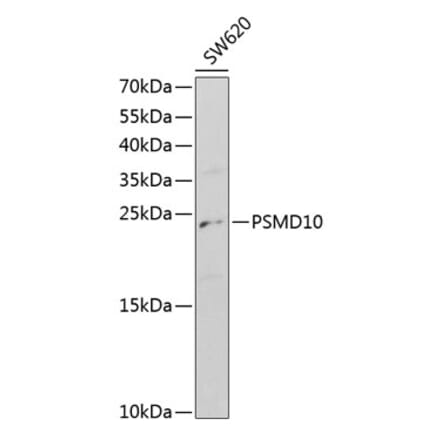Western Blot - Anti-PSMD10 Antibody (A1949) - Antibodies.com