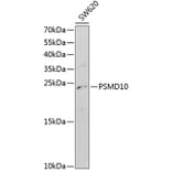 Western Blot - Anti-PSMD10 Antibody (A1949) - Antibodies.com