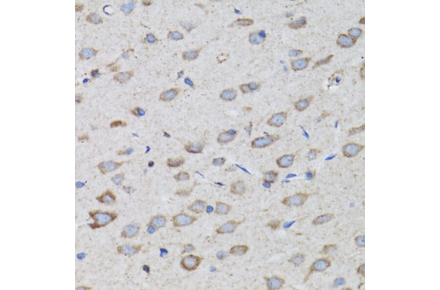 Immunohistochemistry - Anti-PSMD10 Antibody (A1949) - Antibodies.com