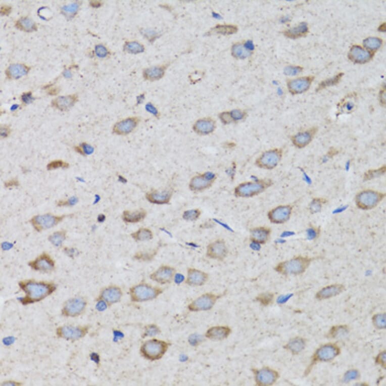 Immunohistochemistry - Anti-PSMD10 Antibody (A1949) - Antibodies.com