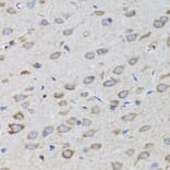 Immunohistochemistry - Anti-PSMD10 Antibody (A1949) - Antibodies.com